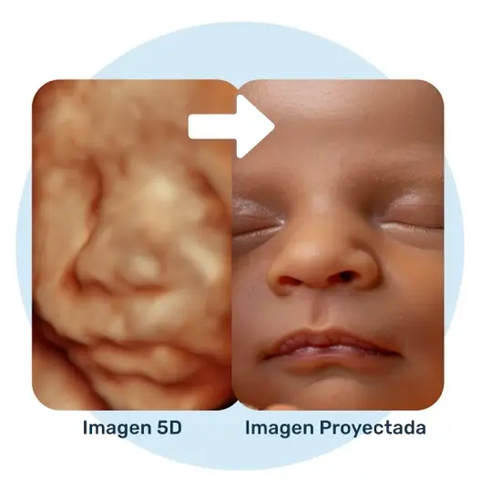 Ecografía Proyectada 7D