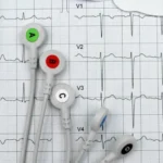 Electrocardiograma, orden médica para electrocardiograma